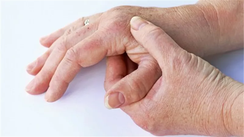 7 أعراض تخبرك أن جسمك في خطر منها اصفرار الجلد والهالات السوداء