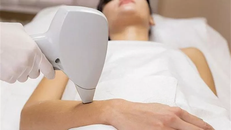 إزالة الشعر بالليزر.. إليكي المميزات و الأضرار قبل تجربته