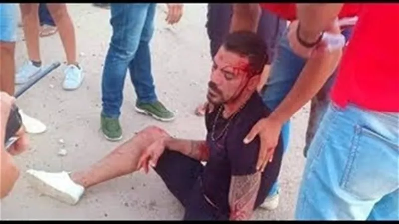 شقيق عمرو زكى يكشف تطوراته الصحية بعد نقله للقاهرة
