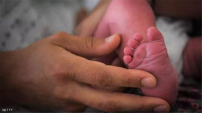 امرأة ميتة دماغيا تنجب طفلة سليمة في التشيك