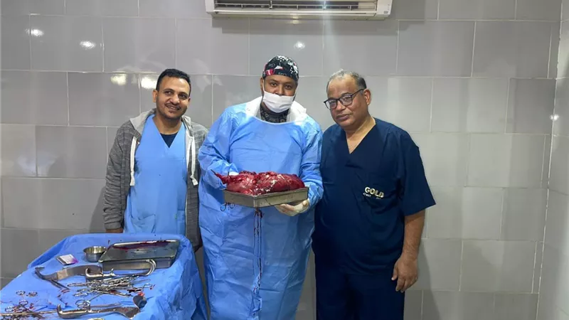 نجاح جراحة نادرة بمستشفى قنا العام: استئصال ورم ضخم من المبيض