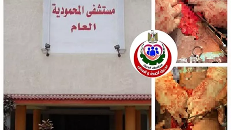 نجاح الفريق الطبي بجراحة مستشفى المحموديه فى انقاذحياة شاب سوداني