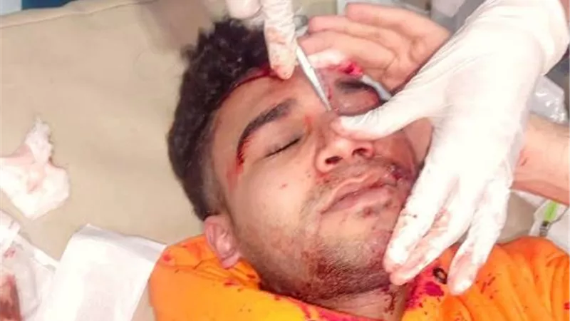 لهو الشباب بالزجاجات والصواريخ أصاب طالب جامعى بالغردقة