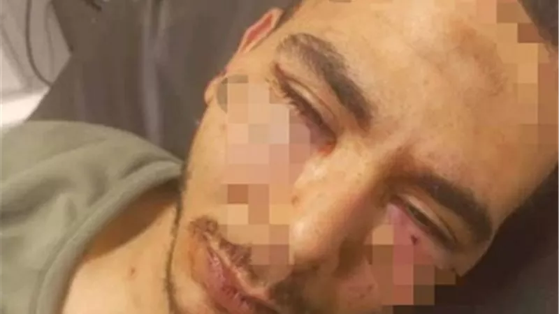 عامل يفقد عينه برصاصة طائشة خلال مشاجرة بين عائلتين بشبرا الخيمة