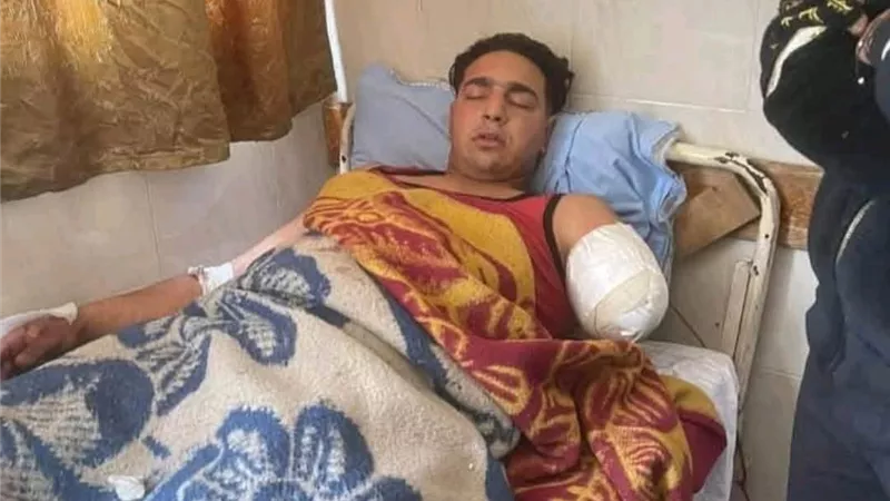 تفاصيل صادمة من شهود العيان بعد بتر ذراع العامل في سيرك طنطا