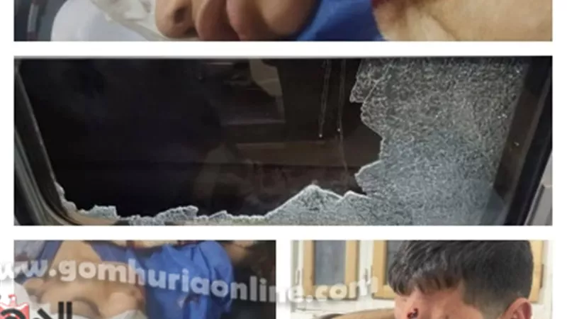 ألقوا الحجارة على القطار في المنوفية.. فأصابوا طفلة من ذوي الهمم