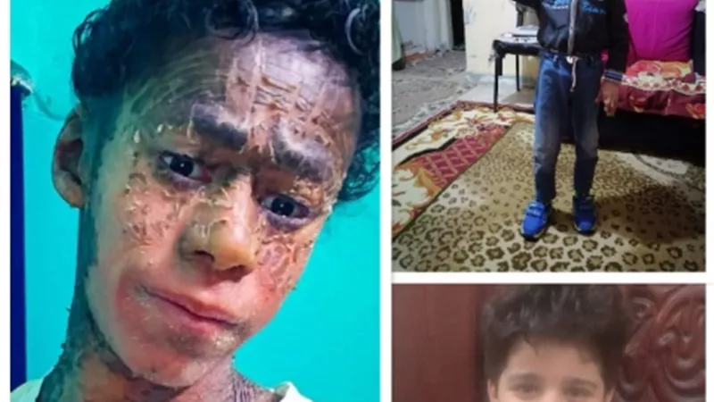 مساعدات شهرية لعشر حالات إنسانية