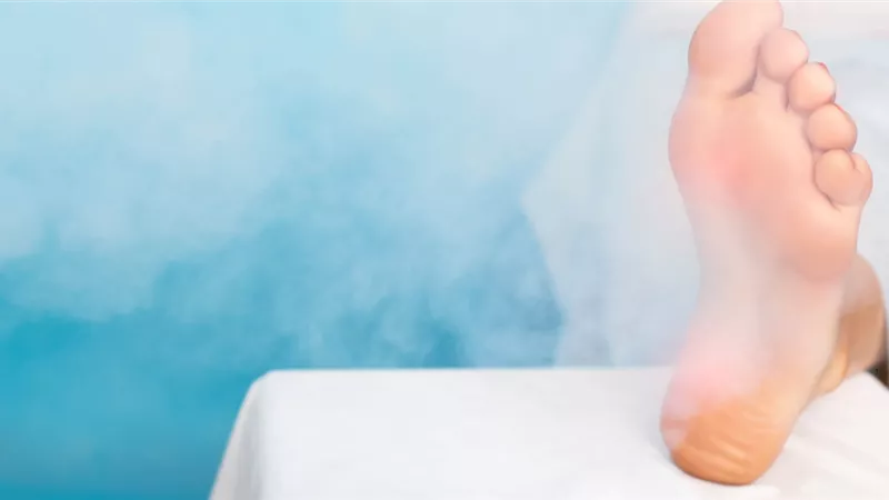 العلاج بالتبريد وأنواعة