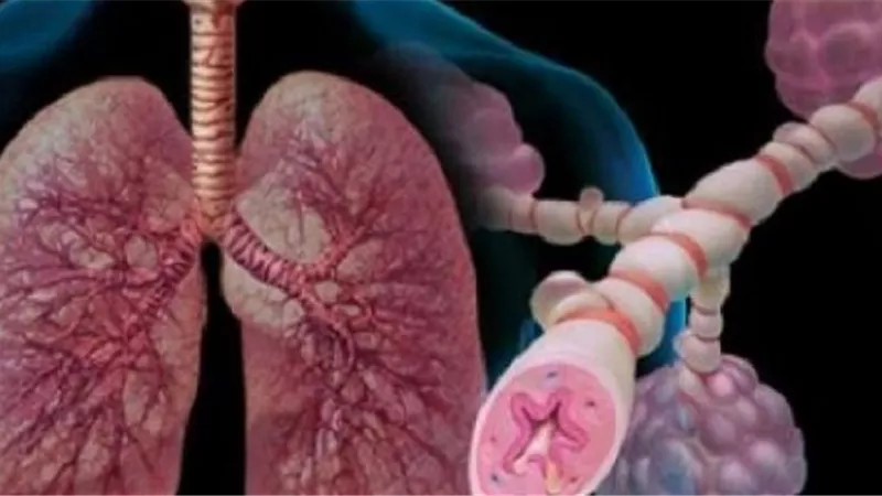 7 حقائق لا تعرفها عن مرض الربو