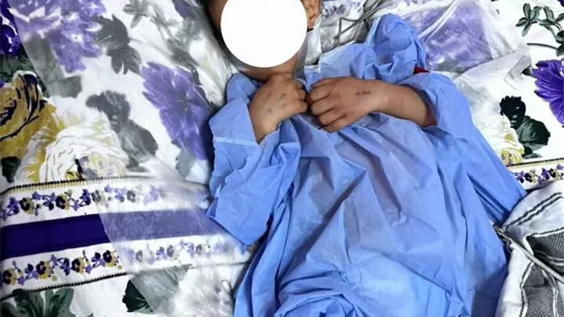 إنقاذ حياة طفل عقب تعرضه لحادث مروع بمستشفيات جامعة سوهاج