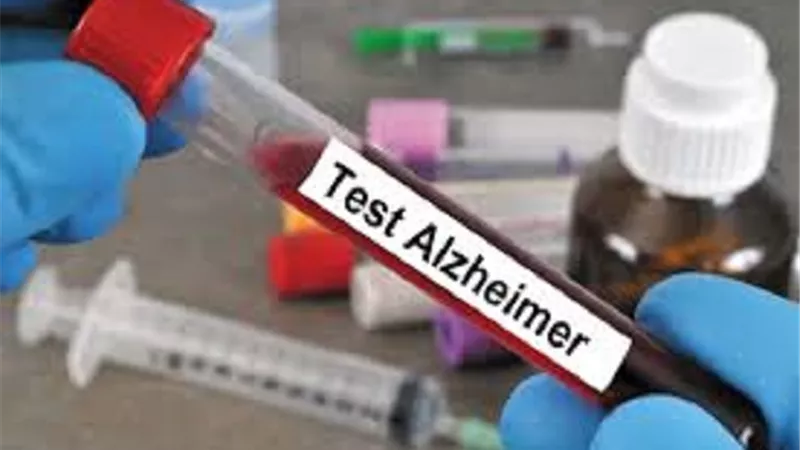 الغذاء والدواء الأميركية تعتمد أول اختبار دم لتشخيص الزهايمر