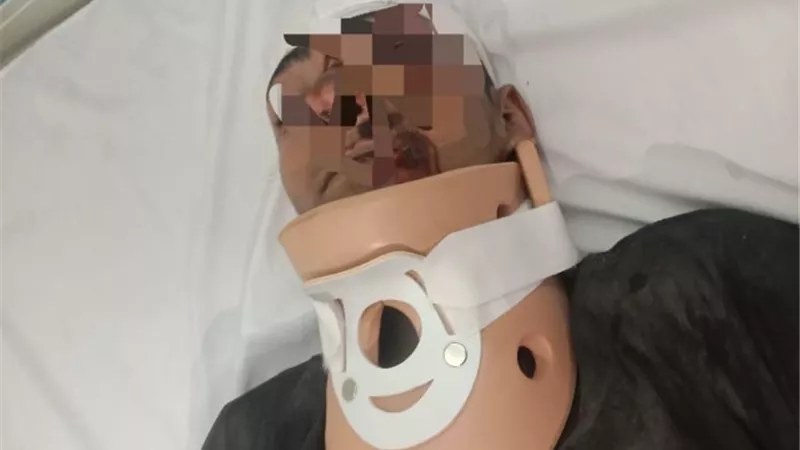 صحة الدقهلية: نجاح جراحة دقيقة لإصلاح كسر بالرقبة في تمى الأمديد