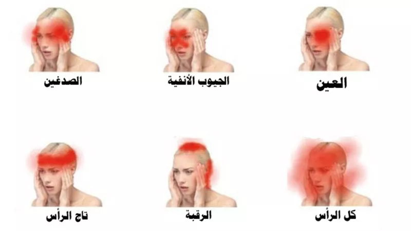 أسباب الصداع الشائعة
