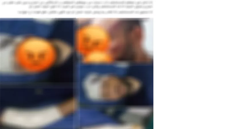 الداخلية تكشف حقيقة ادعاء فني تمريض بالتعدى عليه فى الإسماعيلية