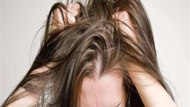 احذرى.. عادة يومية شائعة تسبب الصلع