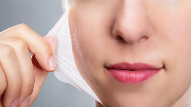 حكم التقشير الكيميائي لتجميل الوجه من التصبغات وحب الشباب