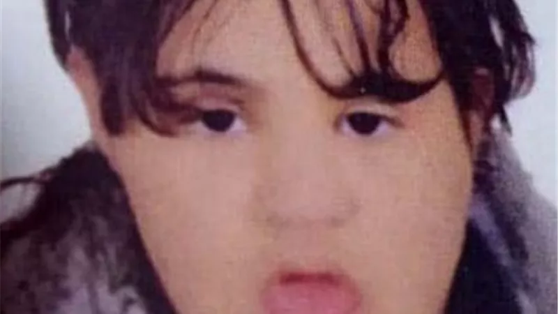 إعاقة ذهنية