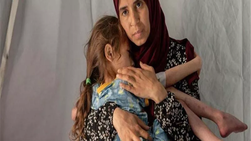 ارتفاع حصيلة الشهداء في غزة إلى أكثر من 57 ألف شهيد منذ بدء العدوان
