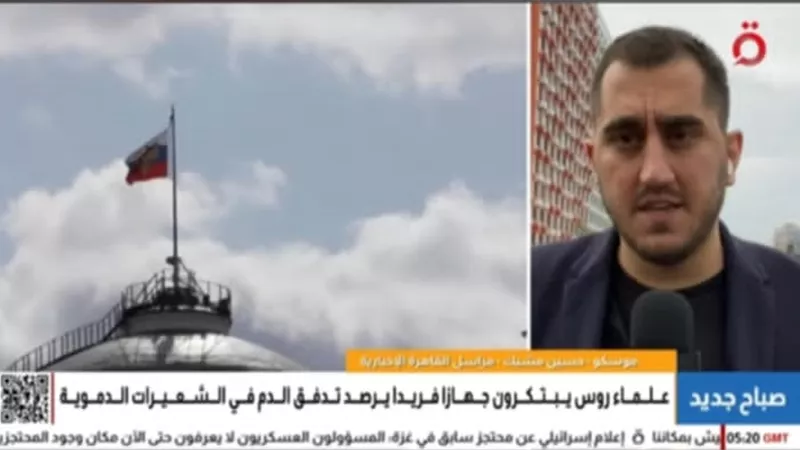 روسيا .. ابتكار طبي جديد بشأن مراقبة تدفق الدم في الشرايين