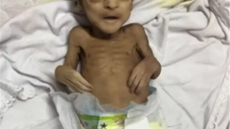وزارة الصحة بغزة: مجزرة صامتة في القطاع.. 76 طفلًا و10 بالغين استشهدوا بسبب الجوع