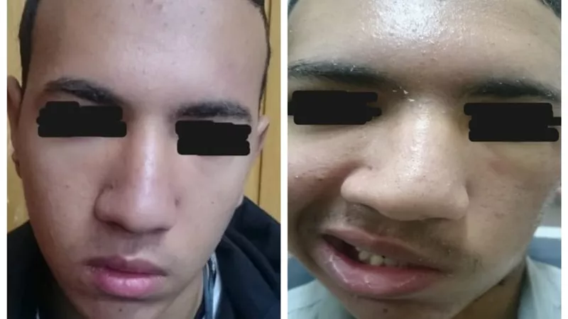 فريق طبي بجامعة أسيوط يعيد الأمل لشاب بعد إصابته بطلق ناري