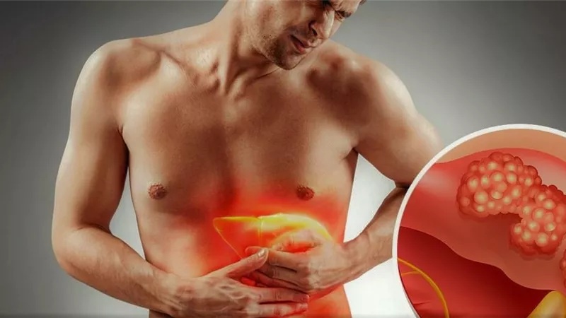 علامات وأعراض تشير إلى مرض الكبد