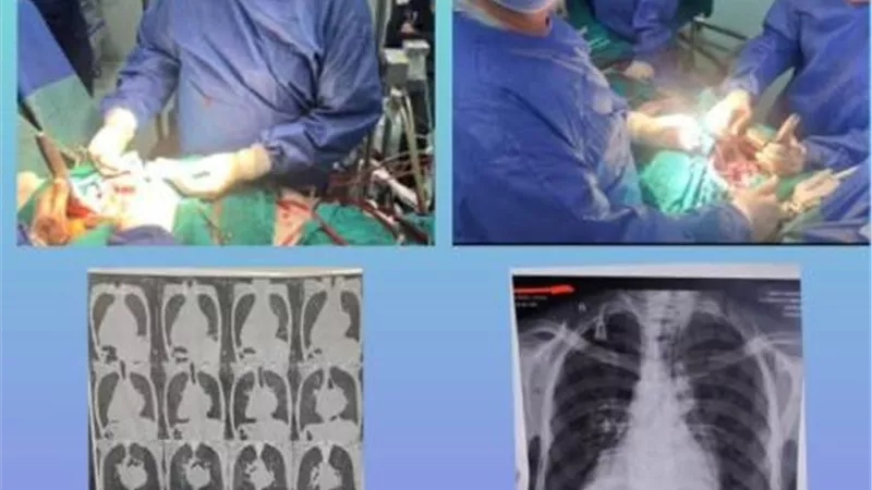 جامعة أسيوط تنجح بإجراء عملية قلب معقدة لمريض لديه 