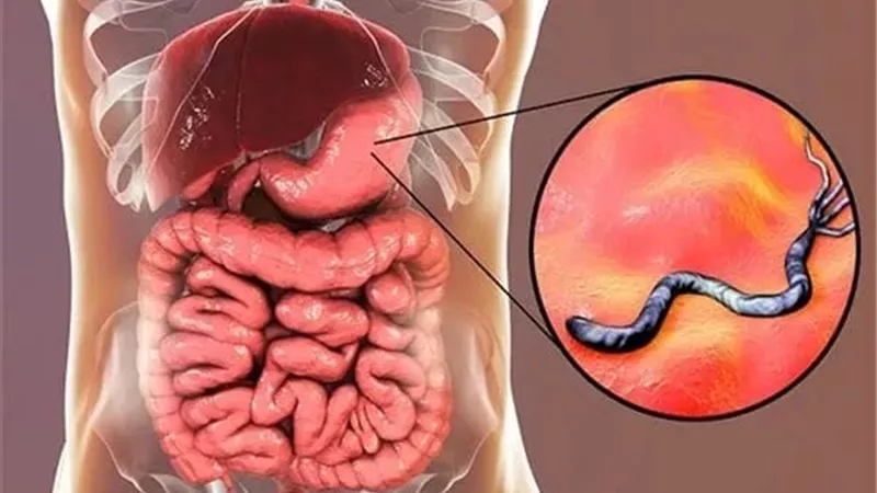 علاجات منزلية مفيدة لجرثومة المعدة