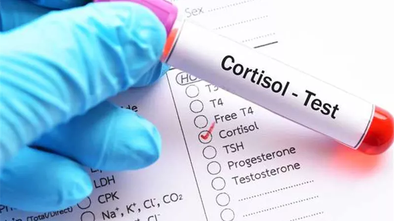 عناصر غذائية تقلل من مستويات الكورتيزول