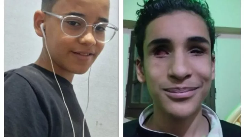 الجراحه تنقذ عينى ياسين وتحميه من مصير شقيقه