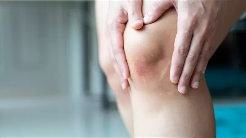 عدم التعرض للشمس في الشتاء يهدد العظام..إليك سبل لحمايتها