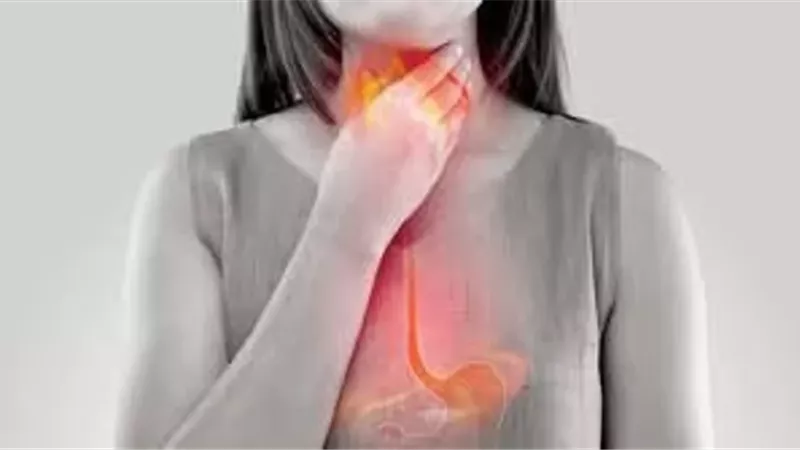10 نصائح للوقاية من ارتجاع المريء