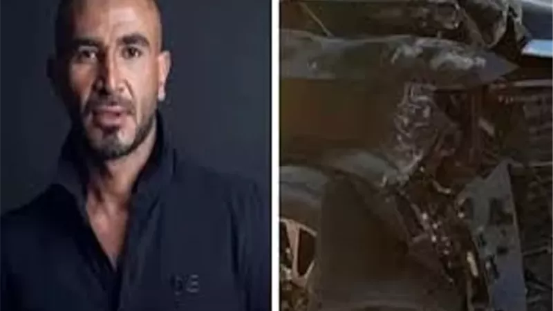 تطورات الحالة الصحية لـ أحمد سعد بعد الحادث