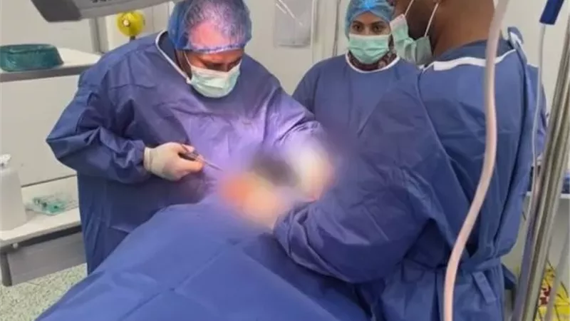 نجاحات نوعية بمستشفى العدوة المركزي فى يوم جراحى مكثف