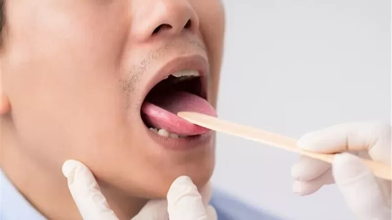 علامات في الفم قد تكشف أمراضاً خطيرة .. طبيبة أسنان توضح