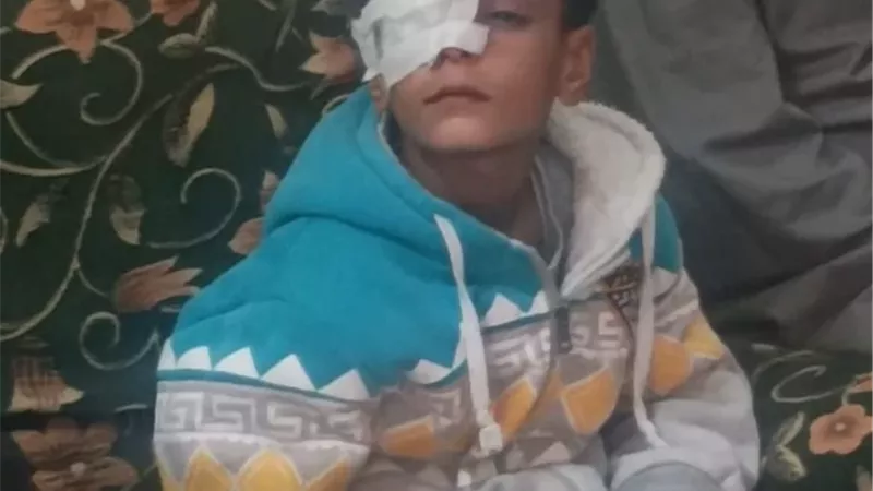 توجيه عاجل من محافظ قنا بشأن طفل فقد عينه بالمدرسة