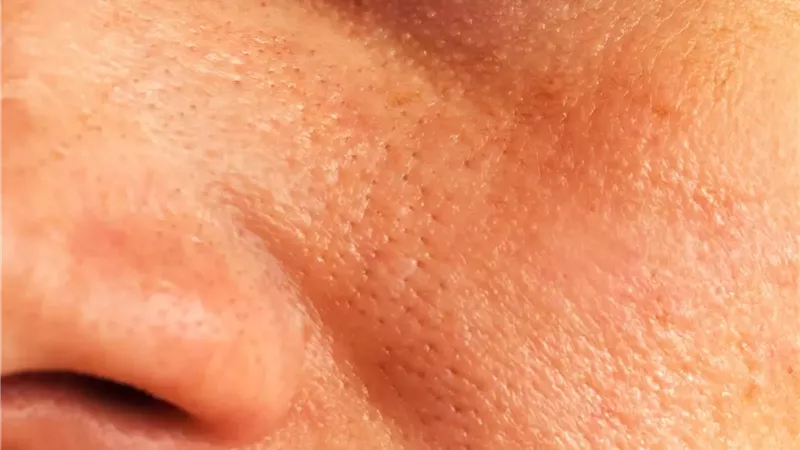أخطاء تسبب اتساع المسام تجنبيها