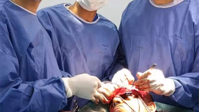 نجاح جراحة إصلاح كسور معقدة بالوجه ومحجر العين بمستشفى السنبلاوين