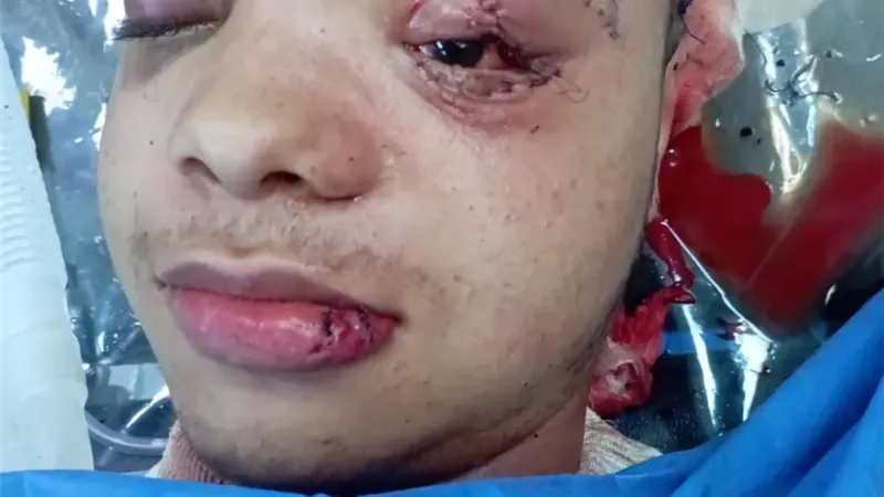 إنقاذ حياة شاب من إصابات بالرأس والوجه