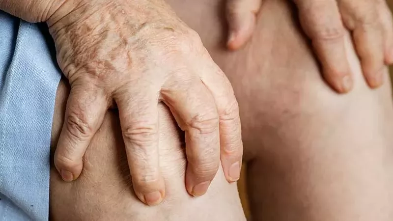 نصائح تمنع التهاب المفاصل