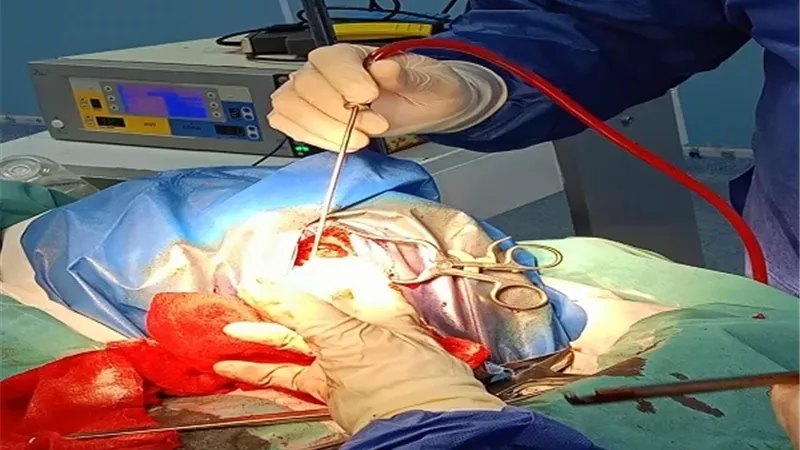 باستخدام جراحات اليقظة نجاح جراحة مخ وأعصاب دقيقة بالدقهلية