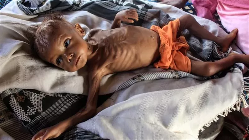 21 مليون سوداني يعانون نقصا حادا في الغذاء