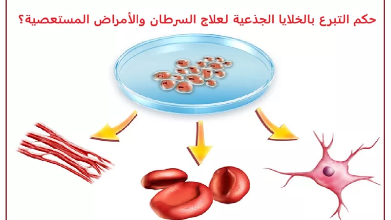 حكم التبرع بالخلايا الجذعية لعلاج السرطان والأمراض المستعصية؟