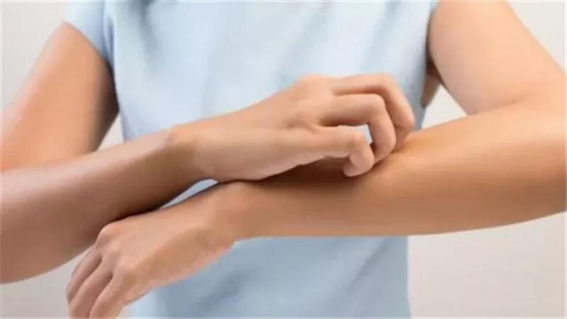 مش برد عادي.. اعرف أعراض حساسية البرد