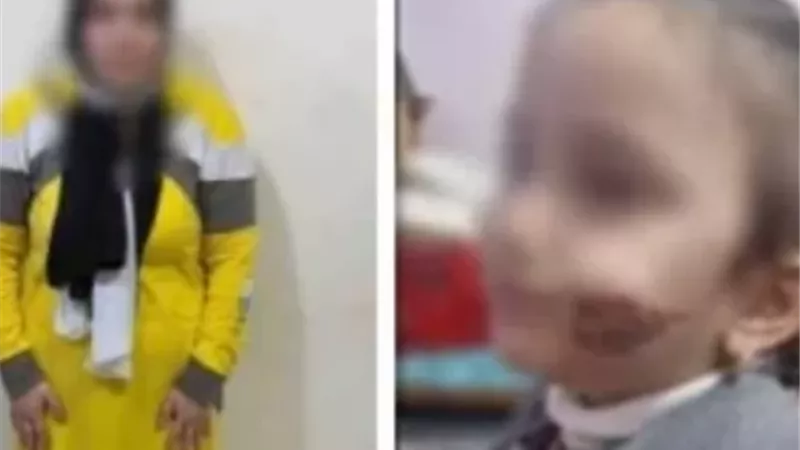 أم استخدمت آداة معدنية ساخنة لتشويه وجه طفلتها