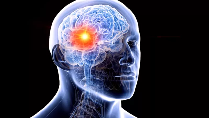 دراسة: إشعاع الرأس للأطفال يزيد خطر الورم السحائي