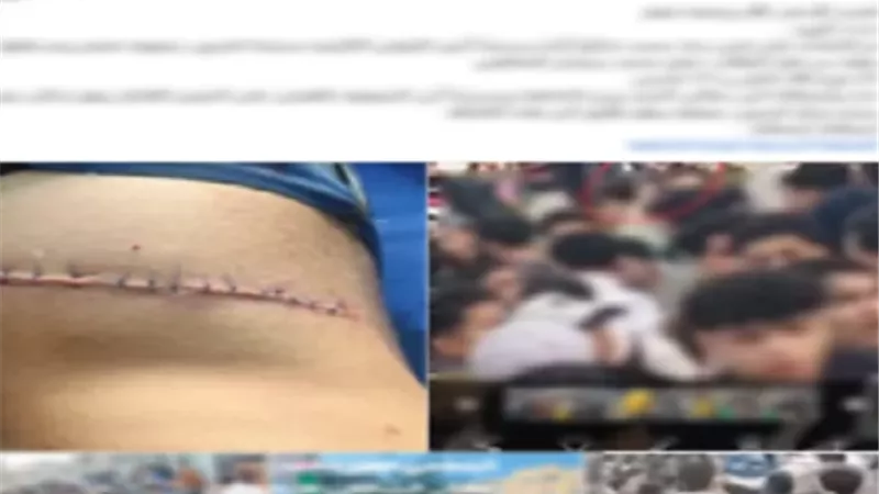 الداخلية تكشف حقيقة التعدي على طالب بسلاح أبيض أمام مدرسة بأشمون