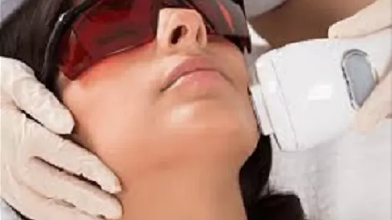 جلسات إزالة الشعر بالليزر وتأثيرها على صحة الصيام فى رمضان