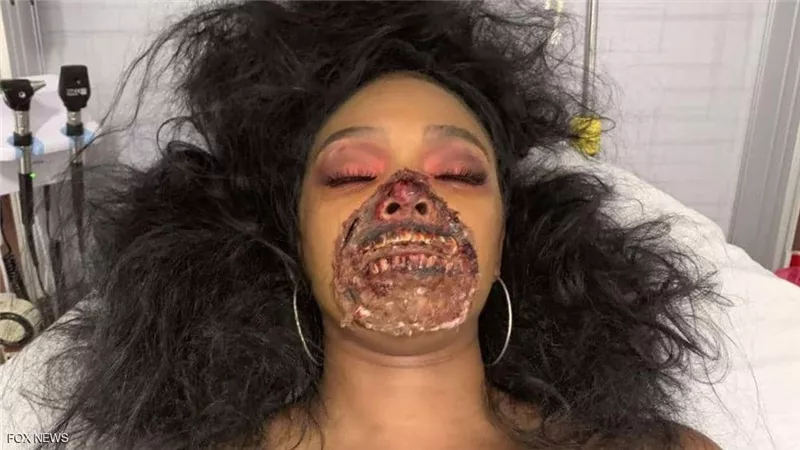 نظرت الى وجهها فى المرآة.. فأصابتها نوبة هلع وانتقلت للمستشفى