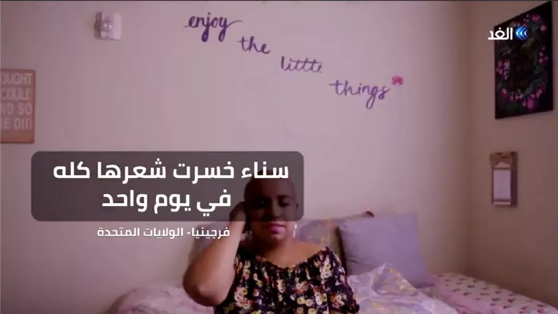 فقدت شعرها بسبب الثعلبة فأطلقت مبادرة حب نفسك